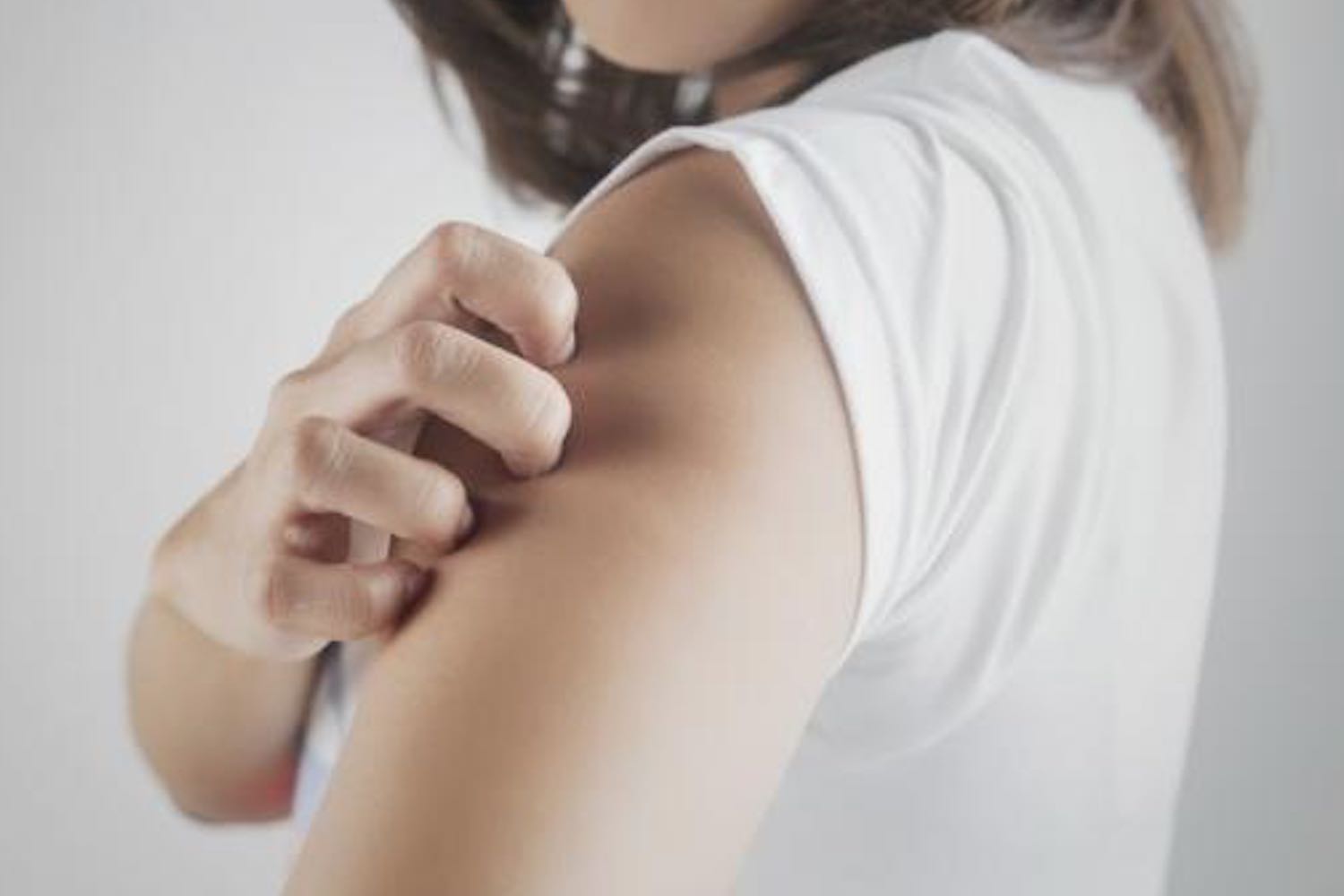 Le méthylisothiazolinone, le champion des démangeaisons, eczémas ou autres dermatites